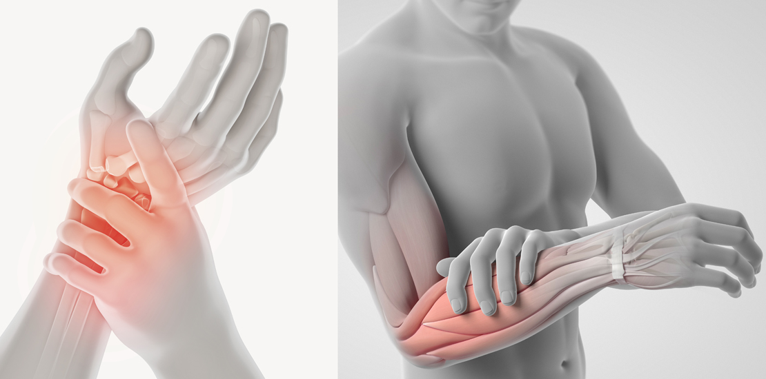 Hand & Upper Limb Injuries & Conditions